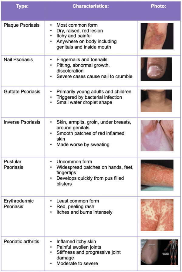 Psoriasis Awareness Month - Innovative Trials