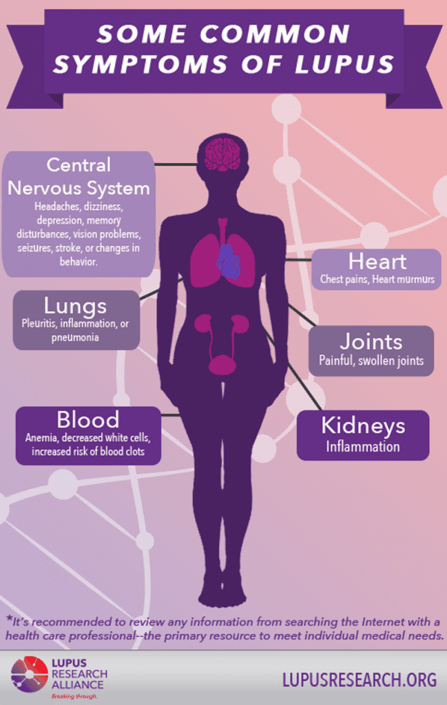 Human body representing commons symptoms of lupus